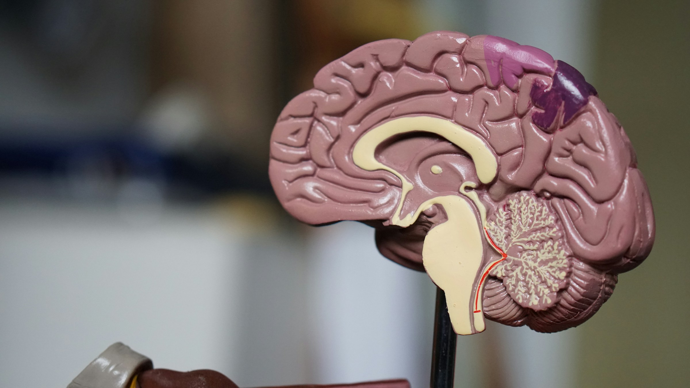 A cut-out of a plastic brain sits on a stand.